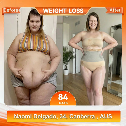 🔥LAST DAY BUY 2, GET 1 FREE 4-in-1 Fat-Burning Shaping Shorts