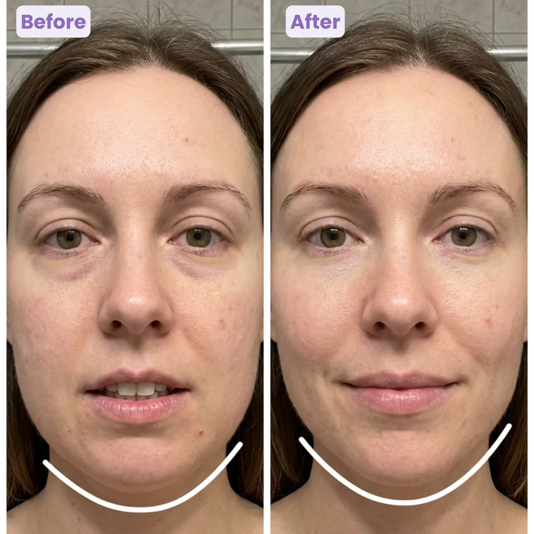 Facial Contour & Lymphatic Drainage Brush